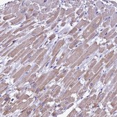 Anti-IDH3A antibody produced in rabbit affinity isolated antibody, buffered aqueous glycerol solution