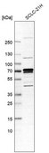 Anti-CAMKK2 antibody produced in rabbit Prestige Antibodies® Powered by Atlas Antibodies, affinity isolated antibody, buffered aqueous glycerol solution