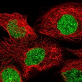 Anti-TNKS antibody produced in rabbit Prestige Antibodies® Powered by Atlas Antibodies, affinity isolated antibody, buffered aqueous glycerol solution