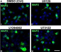 Anticuerpo anti-MAP2, clon AP20 clone AP20, Chemicon®, from mouse