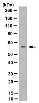 Anti-RAG-2 Antibody, clone 39 culture supernatant, from rabbit