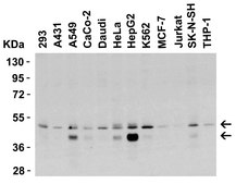 Anti-DR5 Antibody, CT Chemicon®, from rabbit