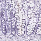 Anti-SI antibody produced in rabbit Prestige Antibodies® Powered by Atlas Antibodies, affinity isolated antibody, buffered aqueous glycerol solution