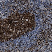 Anti-TOX antibody produced in rabbit Prestige Antibodies® Powered by Atlas Antibodies, affinity isolated antibody, buffered aqueous glycerol solution