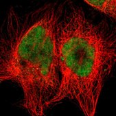 Anti-RTF1 antibody produced in rabbit Prestige Antibodies® Powered by Atlas Antibodies, affinity isolated antibody, buffered aqueous glycerol solution