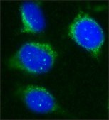 Anti-Sir2 (AS-16) antibody produced in rabbit affinity isolated antibody, buffered aqueous solution