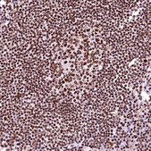 Anti-CPSF6 antibody produced in rabbit Prestige Antibodies® Powered by Atlas Antibodies, affinity isolated antibody, buffered aqueous glycerol solution