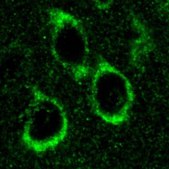 Anti-Presenilin-1 Antibody, loop, a.a. 263-378, CT, clone PS1-loop ascites fluid, clone PS1-loop, Chemicon®