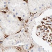 Anti-C4BPA antibody produced in rabbit Ab1, Prestige Antibodies® Powered by Atlas Antibodies, affinity isolated antibody, buffered aqueous glycerol solution