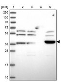 Anti-ARMCX6 antibody produced in rabbit Prestige Antibodies® Powered by Atlas Antibodies, affinity isolated antibody, buffered aqueous glycerol solution