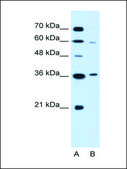 Anti-PARL antibody produced in rabbit affinity isolated antibody