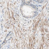 Anti-SEMA4C antibody produced in rabbit Prestige Antibodies® Powered by Atlas Antibodies, affinity isolated antibody, buffered aqueous glycerol solution