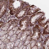 Anti-AEBP1 antibody produced in rabbit Prestige Antibodies® Powered by Atlas Antibodies, affinity isolated antibody, buffered aqueous glycerol solution