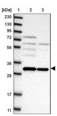 Anti-GEMIN8 antibody produced in rabbit Prestige Antibodies® Powered by Atlas Antibodies, affinity isolated antibody, buffered aqueous glycerol solution