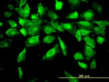 Monoclonal Anti-ACY1 antibody produced in mouse clone 4F1-B7, purified immunoglobulin, buffered aqueous solution