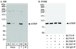 Rabbit anti-ATRIP Antibody, Affinity Purified Powered by Bethyl Laboratories, Inc.