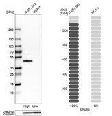 Anti-SPARC antibody produced in rabbit Prestige Antibodies® Powered by Atlas Antibodies, affinity isolated antibody, buffered aqueous glycerol solution