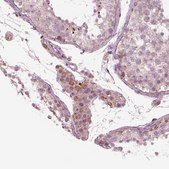 Anti-CELSR3 antibody produced in rabbit Prestige Antibodies® Powered by Atlas Antibodies, affinity isolated antibody, buffered aqueous glycerol solution