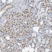 Anti-FOXC1 antibody produced in rabbit Prestige Antibodies® Powered by Atlas Antibodies, affinity isolated antibody, buffered aqueous glycerol solution