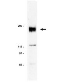 Anti-erbB-2/HER-2 Antibody Upstate®, from rabbit