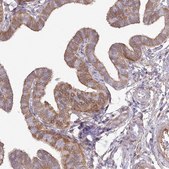 Anti-SH3PXD2B antibody produced in rabbit Prestige Antibodies® Powered by Atlas Antibodies, affinity isolated antibody, buffered aqueous glycerol solution