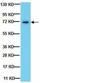 Anti-Endoglin Antibody, clone P3D1 clone P3D1, from mouse