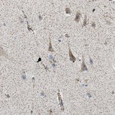 Anti-CAMKK2 antibody produced in rabbit Prestige Antibodies® Powered by Atlas Antibodies, affinity isolated antibody, buffered aqueous glycerol solution