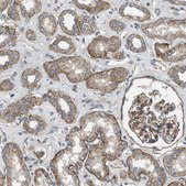 Anti-ERC1 antibody produced in rabbit Prestige Antibodies® Powered by Atlas Antibodies, affinity isolated antibody, buffered aqueous glycerol solution, Ab1