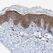 Anti-TRIM65 antibody produced in rabbit Prestige Antibodies® Powered by Atlas Antibodies, affinity isolated antibody, buffered aqueous glycerol solution, Ab2