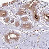 Anti-MADD antibody produced in rabbit Prestige Antibodies® Powered by Atlas Antibodies, affinity isolated antibody, buffered aqueous glycerol solution