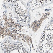 Anti-SELENOK antibody produced in rabbit Prestige Antibodies® Powered by Atlas Antibodies, affinity isolated antibody, buffered aqueous glycerol solution