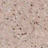 Anti-CAMTA1 antibody produced in rabbit Prestige Antibodies® Powered by Atlas Antibodies, affinity isolated antibody, buffered aqueous glycerol solution