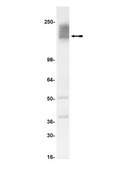 Anti-CFTR Antibody, clone MM13-4 clone MM13-4, Upstate®, from mouse