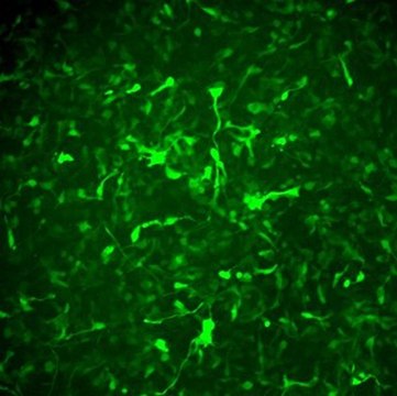Alzheimer&#8217;s In A Dish&#8482; APPSL-GFP Lentivirus