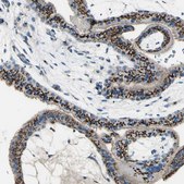 Anti-B4GALT1 antibody produced in rabbit Ab2, Prestige Antibodies® Powered by Atlas Antibodies, affinity isolated antibody, buffered aqueous glycerol solution