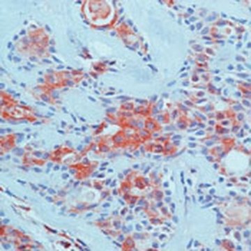 Anti-VEGF (Ab-4) Rabbit pAb liquid, Calbiochem&#174;