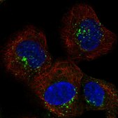 Anti-SNX2 antibody produced in rabbit Prestige Antibodies® Powered by Atlas Antibodies, affinity isolated antibody, buffered aqueous glycerol solution
