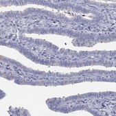 Anti-CDHR3 antibody produced in rabbit Prestige Antibodies® Powered by Atlas Antibodies, affinity isolated antibody, buffered aqueous glycerol solution