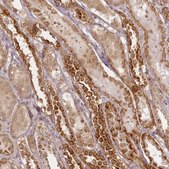 Anti-CHCHD2 antibody produced in rabbit Prestige Antibodies® Powered by Atlas Antibodies, affinity isolated antibody, buffered aqueous glycerol solution