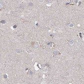 Anti-UIMC1 antibody produced in rabbit Prestige Antibodies® Powered by Atlas Antibodies, affinity isolated antibody, buffered aqueous glycerol solution