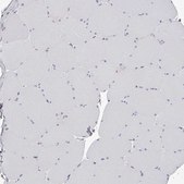 Anti-PACSIN1 antibody produced in rabbit Prestige Antibodies® Powered by Atlas Antibodies, affinity isolated antibody, buffered aqueous glycerol solution