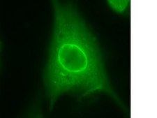 Anti-LAP2 Antibody from rabbit, purified by affinity chromatography