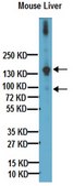 Anti-Mouse Collagen Type I Antibody Chemicon®, from rabbit