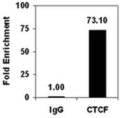 Magna ChIP®プロテインG磁気ビーズ Recombinant Protein G covalently bound to magnetic beads for use in chromatin immunoprecipitations (ChIP assays). These protein G beads provide users a more rapid, reproducible &amp; efficient reagent for collecting immunocomplexes vs. agarose beads.