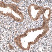 Monoclonal Anti-PIK3CA antibody produced in mouse Prestige Antibodies® Powered by Atlas Antibodies, clone CL8347, purified immunoglobulin, buffered aqueous glycerol solution