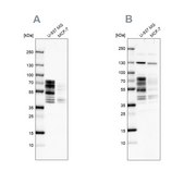 Anti-PPHLN1 antibody produced in rabbit Prestige Antibodies® Powered by Atlas Antibodies, affinity isolated antibody, buffered aqueous glycerol solution