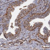 Anti-VIM antibody produced in rabbit Prestige Antibodies® Powered by Atlas Antibodies, affinity isolated antibody, buffered aqueous glycerol solution