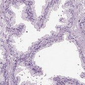Anti-HYDIN antibody produced in rabbit Prestige Antibodies® Powered by Atlas Antibodies, affinity isolated antibody