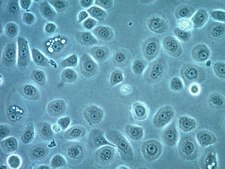 A2EN Human Endocervical Epithelial Cell Line A2EN endocervical epithelial cell line can be used to study sexually transmitted pathogen infections, pathogenesis and the innate immune response.