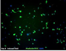 BLaER1 Human B-cell Precursor Leukemia Cell Line BLaER1 human B-cell precursor leukemia cell line may be transdifferentiated and used to model human monocytes.